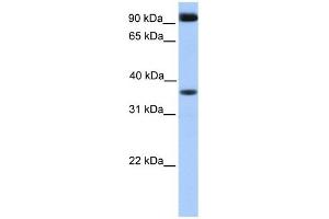 DCUN1D4 antibody used at 1 ug/ml to detect target protein. (DCUN1D4 antibody)