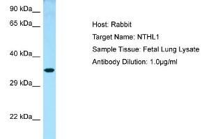 Western Blotting (WB) image for anti-Nth Endonuclease III-Like 1 (NTHL1) (N-Term) antibody (ABIN2789777) (Nth Endonuclease III-Like 1 (NTHL1) (N-Term) antibody)