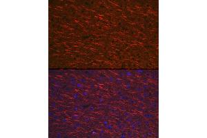 Immunofluorescence analysis of mouse brain cells using M Rabbit pAb (ABIN3016264, ABIN3016265, ABIN3016266, ABIN1680752 and ABIN6219676) at dilution of 1:100 (40x lens). (MAP2 antibody  (AA 260-559))