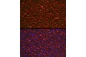 Immunofluorescence analysis of mouse brain cells using M Rabbit pAb (ABIN3016264, ABIN3016265, ABIN3016266, ABIN1680752 and ABIN6219676) at dilution of 1:100 (40x lens). (MAP2 antibody  (AA 260-559))