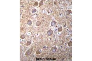 Immunohistochemistry (IHC) image for anti-RAS Guanyl Releasing Protein 2 (Calcium and DAG-Regulated) (RASGRP2) antibody (ABIN2996572) (RASGRP2 antibody)