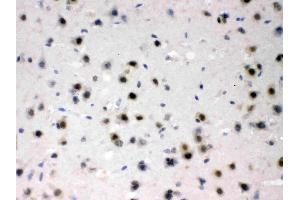 AZIN2 was detected in paraffin-embedded sections of mouse brain tissues using rabbit anti- AZIN2 Antigen Affinity purified polyclonal antibody (Catalog # ) at 1 µg/mL. (ADC antibody  (AA 111-301))