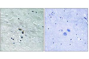 Immunohistochemistry analysis of paraffin-embedded human brain tissue using MAP3K8 (epitope around residue 400) antibody. (MAP3K8 antibody  (Ser400))