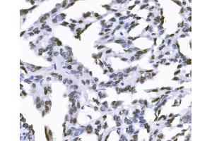 IHC analysis of SUN2 using anti-SUN2 antibody (ABIN7601278).