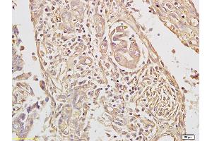 Formalin-fixed and paraffin embedded rat brain labeled with Rabbit Anti TAK1/MAP3K7 Polyclonal Antibody, Unconjugated (ABIN701185) at 1:200 followed by conjugation to the secondary antibody and DAB staining (TR4 antibody  (AA 560-600))