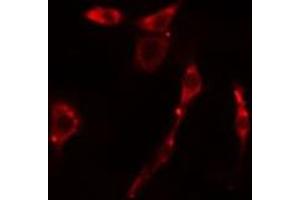 ABIN6277964 staining HepG2 cells by IF/ICC. (KSR1 antibody  (Internal Region))