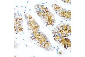 Immunohistochemistry of paraffin-embedded human stomach using SIRT1 antibody (ABIN5970059) at dilution of 1/100 (40x lens). (SIRT1 antibody  (C-Term))