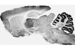 Adult rat brain immunohistochemistry. (Cav3.1 Ca2+ Channel (AA 2052-2172), (C-Term), (Cytosolic) antibody)