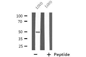 Western blot analysis of extracts from LOVO cells, using KRT37/38 antibody. (KRT37,38 antibody)