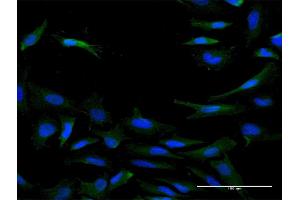 Immunofluorescence of purified MaxPab antibody to IL20RB on HeLa cell. (IL20RB antibody  (AA 1-147))
