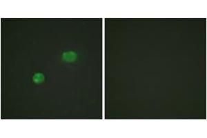 Immunofluorescence analysis of HeLa cells, using c-Jun (Ab-231) Antibody. (C-JUN antibody  (AA 201-250))