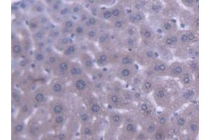 DAB staining on IHC-P; Samples: Mouse Liver Tissue (ABCB9 antibody  (AA 500-762))