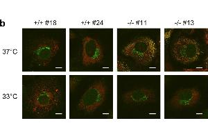 Immunofluorescence (Cultured Cells) (IF (cc)) image for anti-COL1A2/COL1A1 antibody (ABIN5596819)