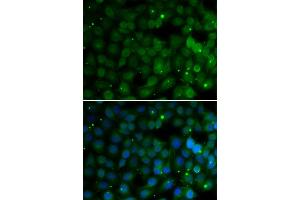 Immunofluorescence analysis of U20S cell using HPD antibody. (HPD antibody)
