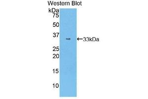 Western Blotting (WB) image for anti-Signal Transducer and Activator of Transcription 1, 91kDa (STAT1) (AA 343-602) antibody (ABIN1860646)