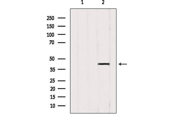 ACAA1 antibody  (N-Term)