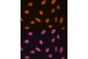 Immunofluorescence analysis of U-2 OS cells using SET/T Rabbit mAb (ABIN7270265) at dilution of 1:100 (40x lens). (SET/TAF-I antibody)