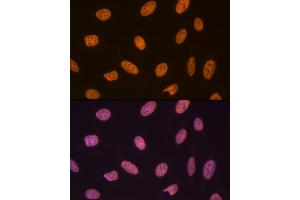 Immunofluorescence analysis of U-2 OS cells using SET/T Rabbit mAb (ABIN7270265) at dilution of 1:100 (40x lens). (SET/TAF-I antibody)