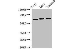 Western Blot Positive WB detected in: Raji whole cell lysate, Mouse lung tissue, Mouse stomach tissue All lanes: FOXN1 antibody at 2. (FOXN1 antibody  (AA 1-160))