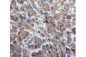 Used in DAB staining on fromalin fixed paraffin-embedded Pancreas tissue (NCF2 antibody  (AA 355-526))
