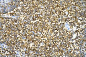 Immunohistochemistry was performed on paraffin-embedded human tonsillitis using CD44 antibody (ABIN7797973), 1:200). (Recombinant CD44 antibody)