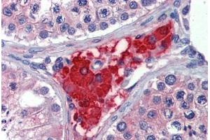 Human Testis: Formalin-Fixed, Paraffin-Embedded (FFPE) (PRTFDC1 antibody  (Internal Region))