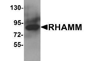 Western blot analysis of RHAMM in rat stomach tissue lysate with RHAMM antibody at 1 µg/mL. (HMMR antibody  (N-Term))