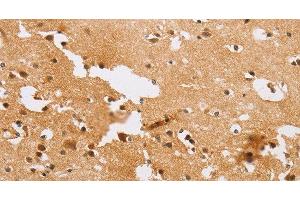 Immunohistochemistry of paraffin-embedded Human brain tissue using ACTR2 Polyclonal Antibody at dilution 1:40 (ACTR2 antibody)