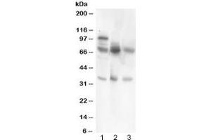 Western blot testing of GAD67 antibody and Lane 1:  rat brain;  2: human HeLa;  3: (h) COLO320. (GAD antibody  (AA 14-122))