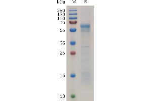 SDS-PAGE (SDS) image for Prion Protein (PRNP) (AA 23-229) protein (Fc Tag) (ABIN7490839)