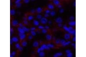 Immunofluorescence analysis of Rat kidney tissue using JAK3 Polyclonal Antibody at dilution of 1:200. (JAK3 antibody)