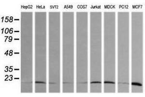 Image no. 2 for anti-HRas proto-oncogene, GTPase (HRAS) antibody (ABIN1498713) (HRAS antibody)