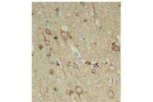 Immunohistochemistry of paraffin-embedded rat hippocampal region tissue from a model with Alzheimer, using Phospho-MAPT-S396 antibody (ABIN2987482). (MAPT antibody  (pSer396))