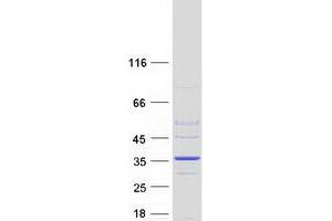 Western Blotting (WB) image for Dehydrogenase/reductase (SDR Family) Member 9 (DHRS9) (Transcript Variant 2) protein (Myc-DYKDDDDK Tag) (ABIN2719453)