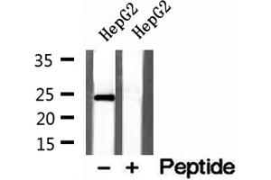 Western blot analysis of extracts of HepG2 cells, using Cyclophilin B antibody. (PPIB antibody  (C-Term))