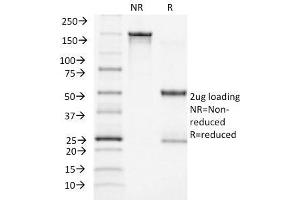 SDS-PAGE Analysis Purified ACTH Monoclonal Antibody (CLIP/1418).