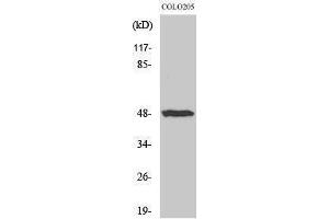 Western Blotting (WB) image for anti-Interleukin 13 Receptor, alpha 1 (IL13RA1) (Ser561) antibody (ABIN3185158) (IL13 Receptor alpha 1 antibody  (Ser561))