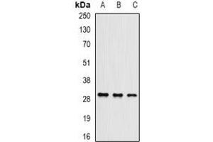 Western blot analysis of UBE2J2 expression in Hela (A), mouse testis (B), mouse brain (C) whole cell lysates. (UBE2J2 antibody)