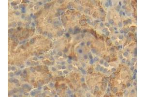 DAB staining on IHC-P; Samples: Mouse Kidney Tissue (BCL2L1 antibody  (AA 2-212))