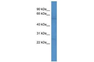 Western Blot showing PDE1A antibody used at a concentration of 1-2 ug/ml to detect its target protein. (PDE1A antibody  (C-Term))