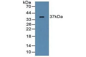 Western blot analysis of Rat Serum. (FCN1 antibody  (AA 25-279))