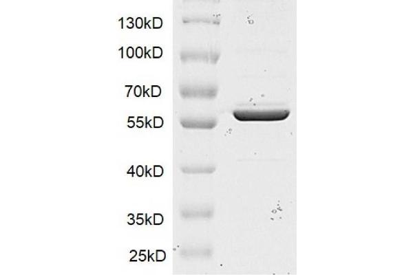 SMYD1 Protein (DYKDDDDK Tag)