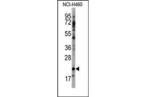 Image no. 1 for anti-Heart and Neural Crest Derivatives Expressed 2 (HAND2) (C-Term) antibody (ABIN358596) (HAND2 antibody  (C-Term))