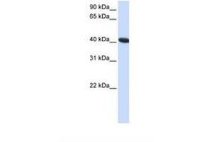 Image no. 1 for anti-Chromosome 1 Open Reading Frame 159 (C1orf159) (AA 241-290) antibody (ABIN6738342)
