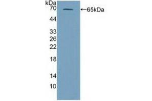 Detection of Recombinant PRF1, Mouse using Polyclonal Antibody to Perforin 1 (PRF1)