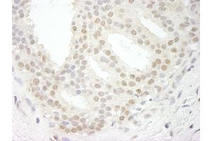 Immunohistochemistry (IHC) image for anti-Ubiquitin Specific Peptidase 34 (USP34) (C-Term) antibody (ABIN7448855) (USP34 antibody  (C-Term))