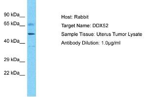 Host: Rabbit Target Name: DDX52 Sample Type: Uterus tumor lysates Antibody Dilution: 1. (DDX52 antibody  (C-Term))