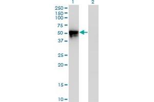 Western Blot analysis of KLF8 expression in transfected 293T cell line by KLF8 monoclonal antibody (M12), clone 3F10. (KLF8 antibody  (AA 1-98))