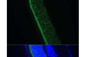 Immunofluorescence analysis of Rat eye using GNGT1 Polyclonal Antibody at dilution of 1:100 (40x lens).