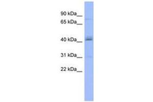 Image no. 1 for anti-Poly(A) Polymerase beta (Testis Specific) (PAPOLB) (AA 431-480) antibody (ABIN6743027) (PAPOLB antibody  (AA 431-480))